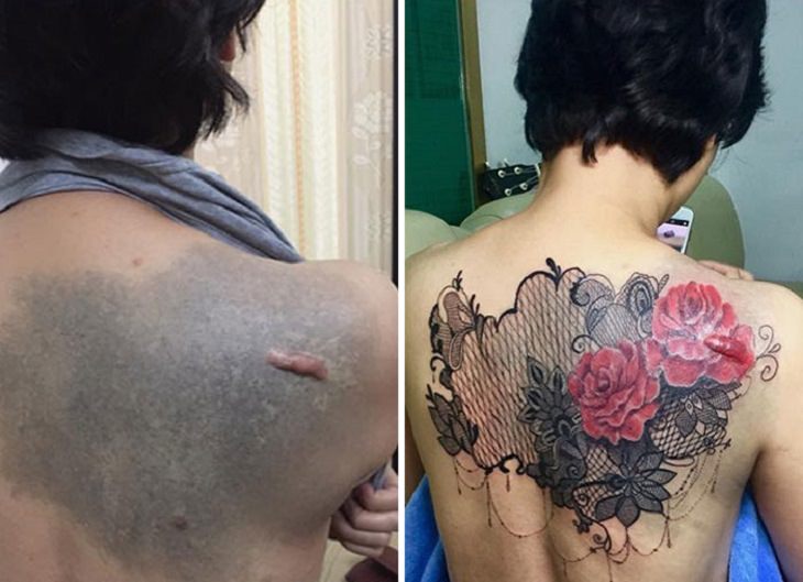 An Artist Transforms Scars Into a Blossoming Symbol of Beauty