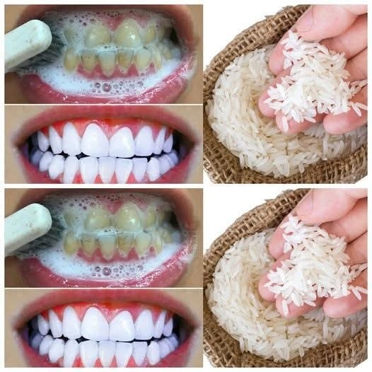 Search Results for: Brighten Your Smile in Just One Minute – A Simple DIY Teeth Whitening Trick!