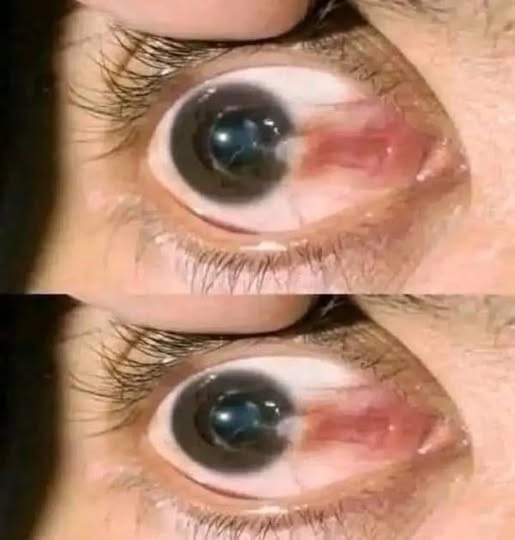 Be Very Careful: If Your Eyes Have These Signals, Your Body Is Sending a Warning