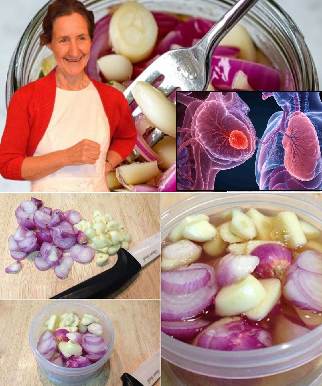 Recipe for Red Onion, Garlic, and Honey to Treat Lungs, Cough, and Colds