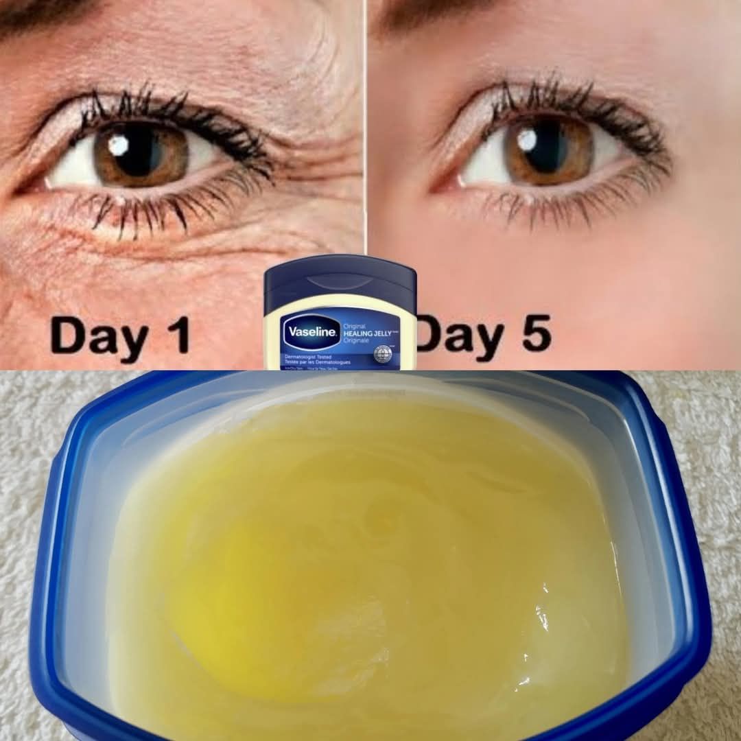 The Power of Vaseline to Remove Wrinkles – Look 20 Years Younger Naturally!