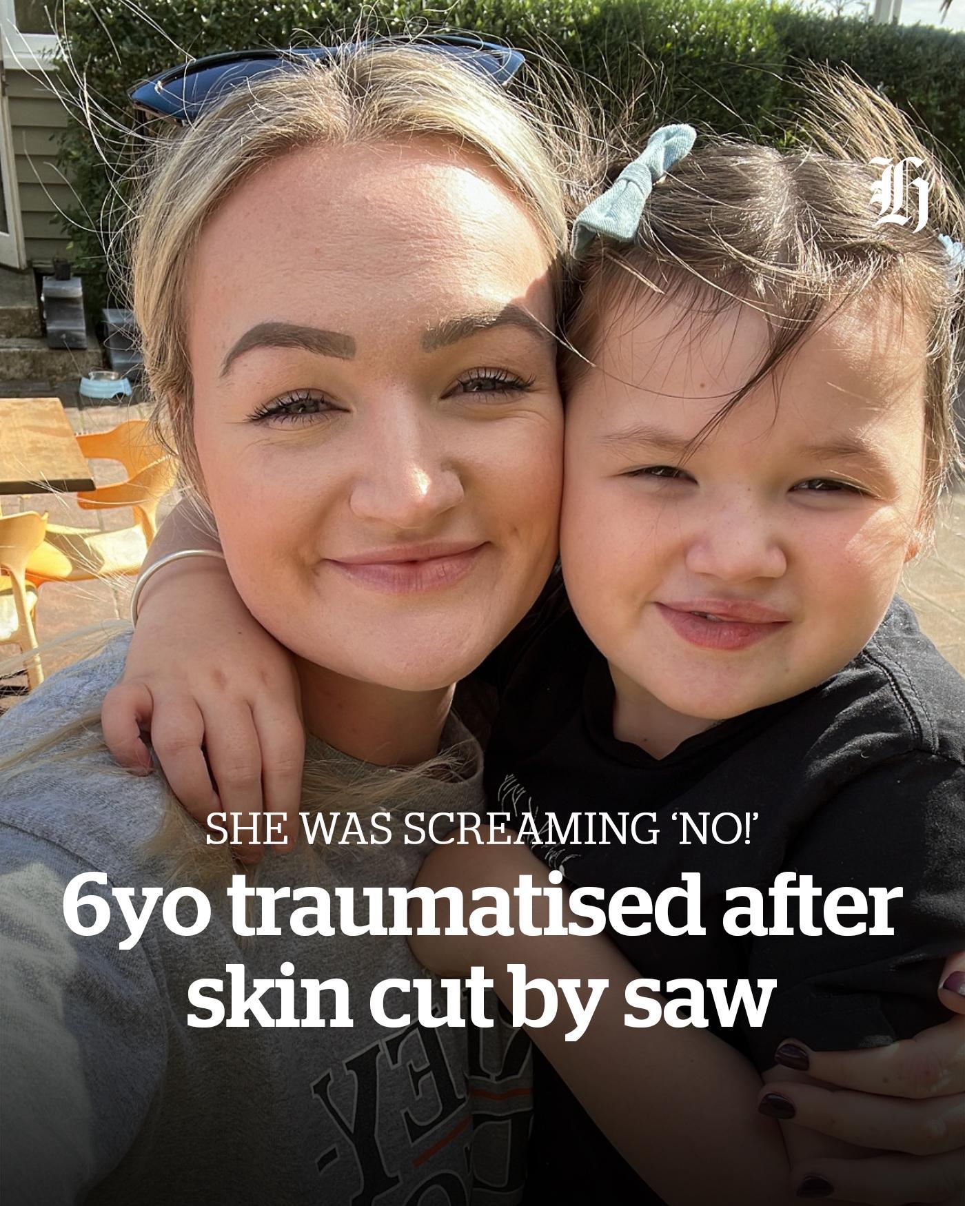 Mother horrified as 6yo cut by nurse using saw to remove cast