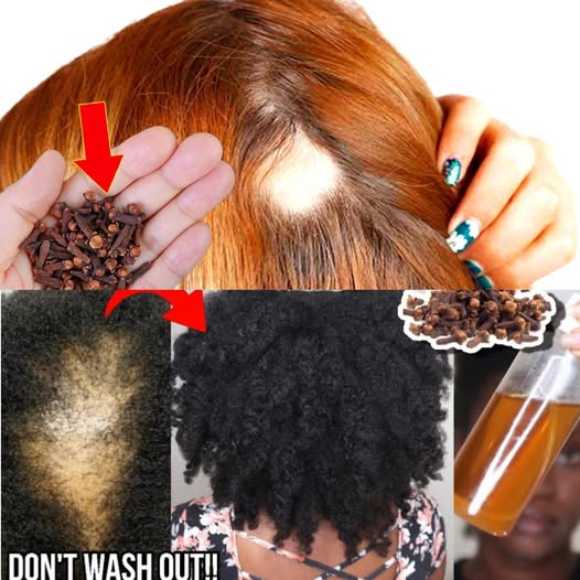 Put Cloves in Your Hair & Stop Spending Money at the Pharmacy! 🌿✨