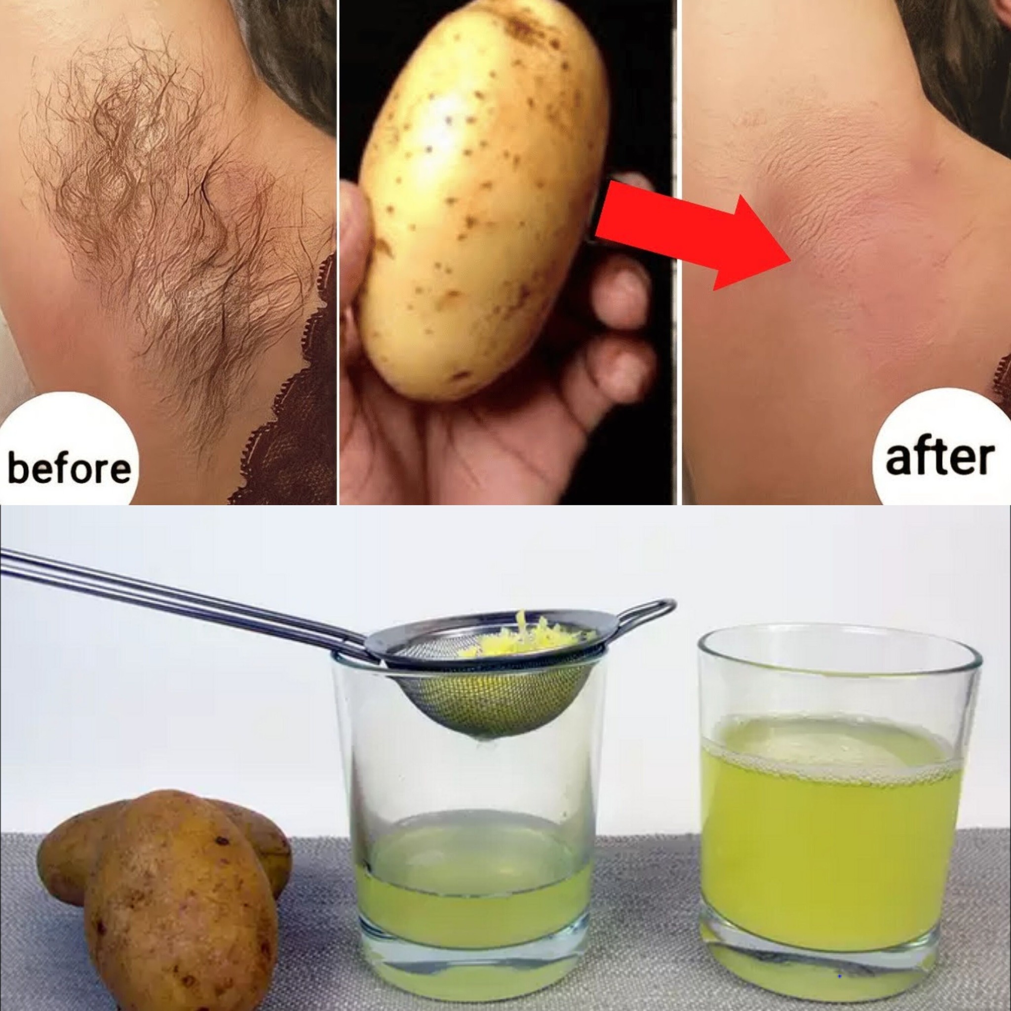 Stop Shaving! Here’s How to Permanently Get Rid of Facial, Body, and Pubic Hair with Potato! 🥔✨