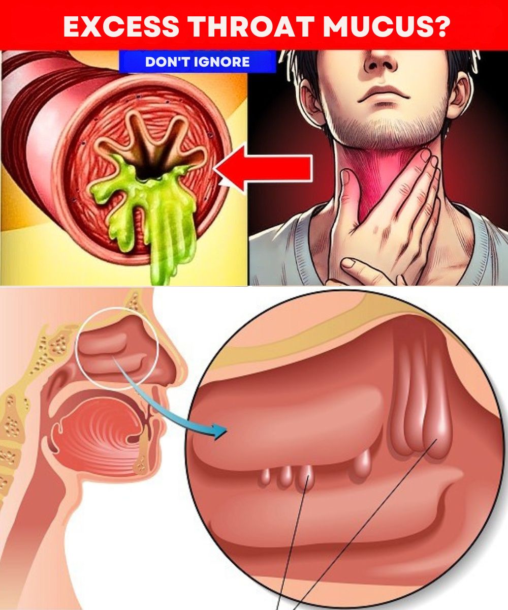 4 Effective Home Remedies to Eliminate Mucus and Phlegm Naturally