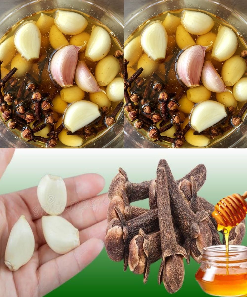 The Health Benefits of Mixing Garlic, Cloves, and Honey: A Natural Remedy for 15 Ailments