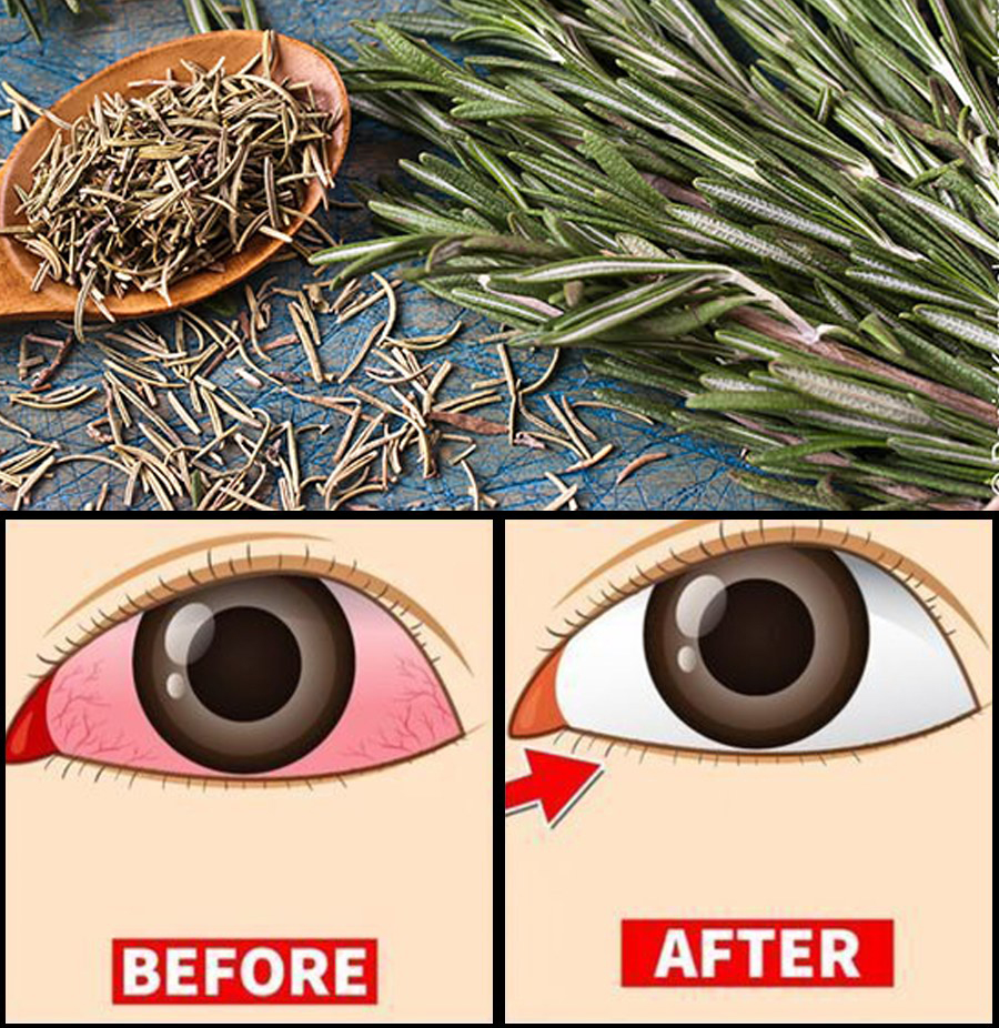 5 Herbs that Protect Eyes and Repair Vision