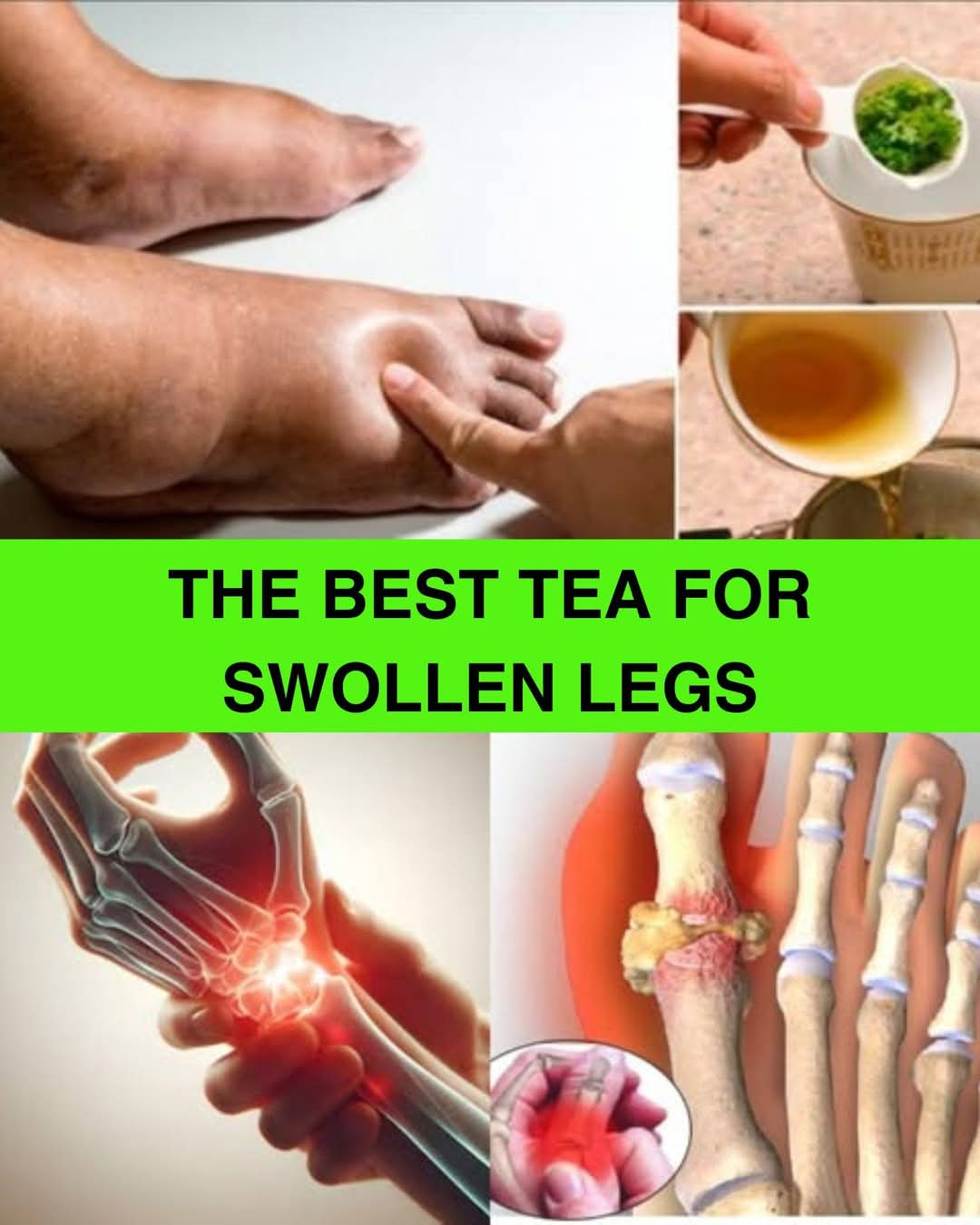 The Best Tea for Swollen Legs: A Natural Diuretic for Ankles and Feet