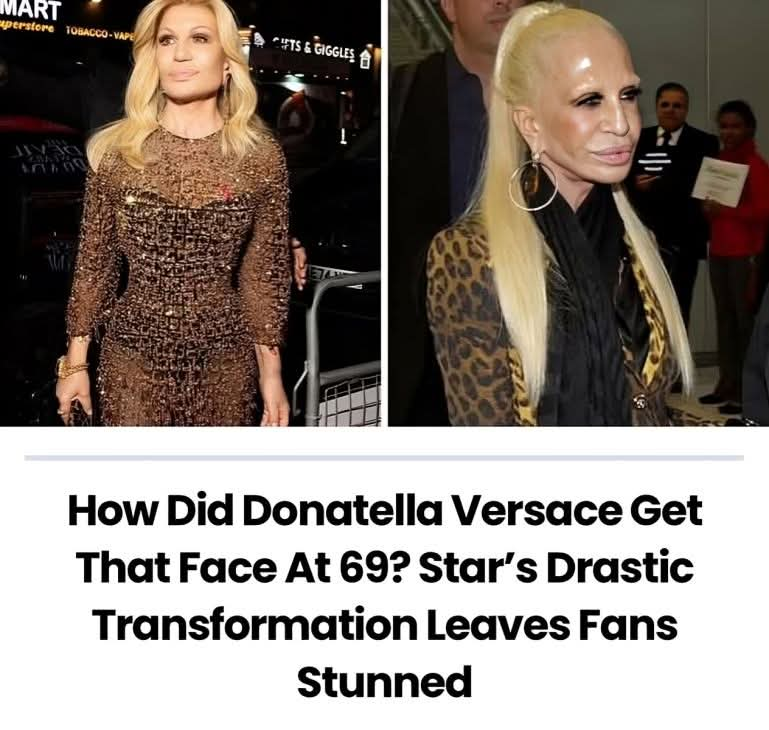 Donatella Versace’s new face leaves fans shaken