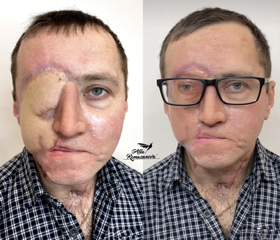 A Tattoo Artist Uses Her Magic Touch to Ink a “New Permanent Eye” for a Man After Tragedy