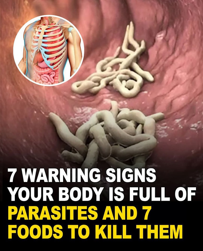 10 Warning Signs of Parasites in Your Body