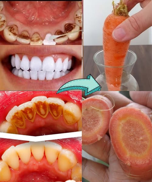 Natural Teeth Whitening With Carrot Tops – Simple Remedy