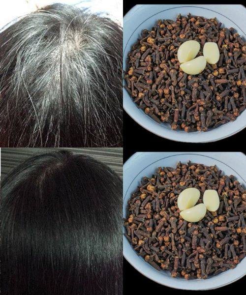 Garlic and Clove Benefits for Healthy Hair Growth
