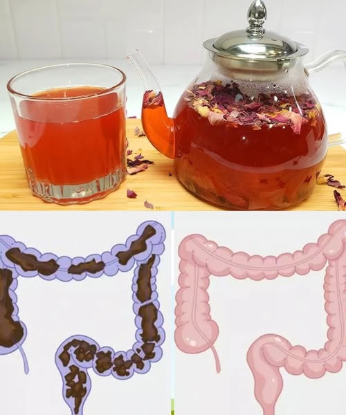 Why Gut Detox is Essential for Digestion and Wellness