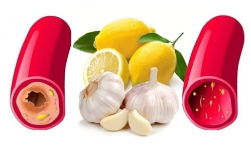 Top 12 Foods That Naturally Unclog Arteries