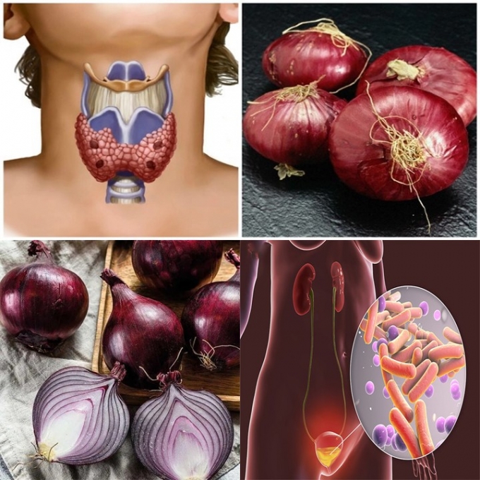 Onions: The Bladder & Prostate Hero You’re Not Eating Enough